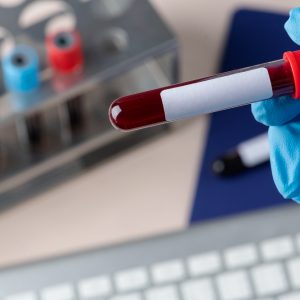 Peripheral Blood Film Preparation and Interpretation Competency Program